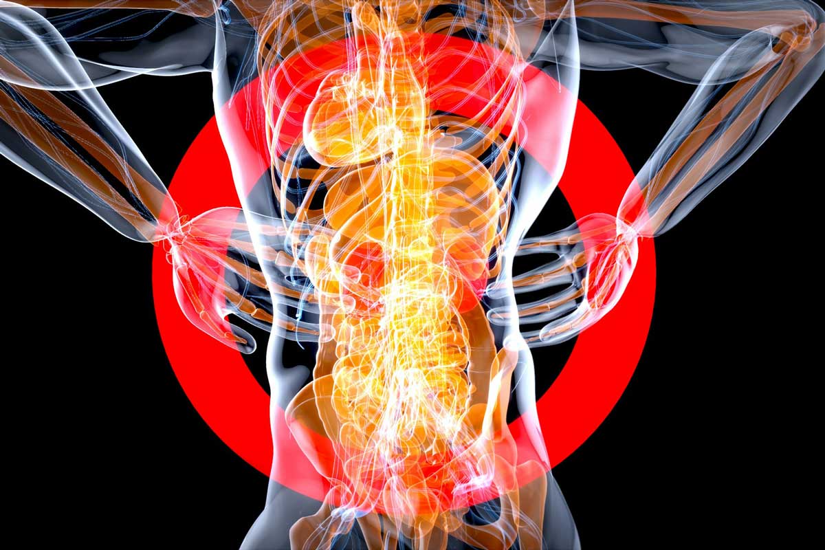 Sciatica Treatment Charlotte: Why the Pain Keeps Coming Back